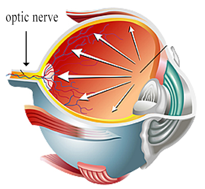 Glaucoma Pressure Illustration