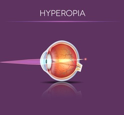 Hyperopia Diagram