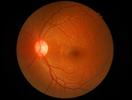 central florida retina