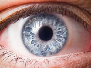 Woman with Dry Macular Degeneration in West Palm Beach